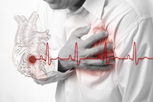 Inverno aumenta risco de infarto em até 30%