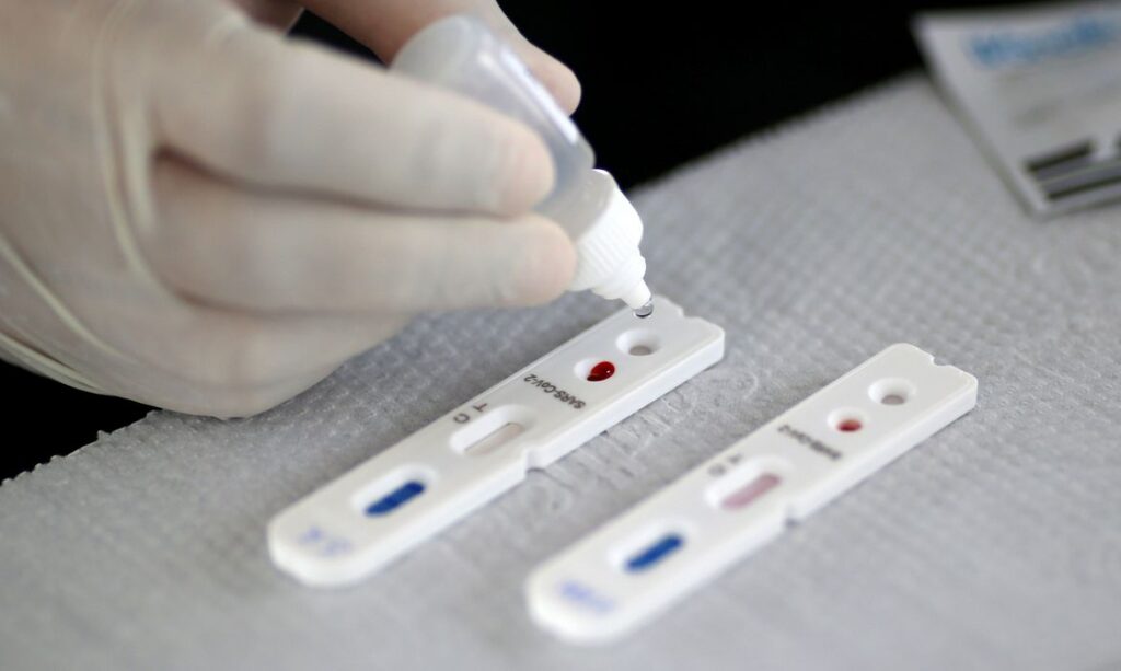 Teste novo coronavírus. Imagem: Agência Brasil