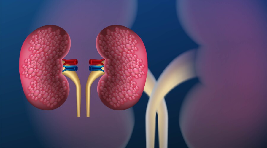 Doença renal crônica subdiagnosticada causa mortes