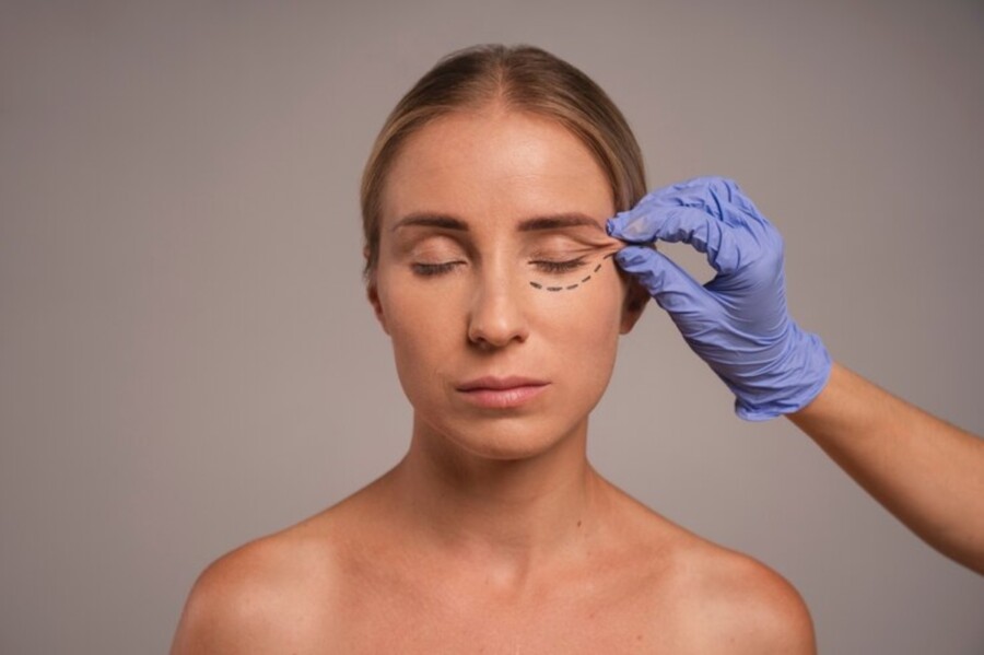 Blefaroplastia é o 3º procedimento mais realizado em 2023