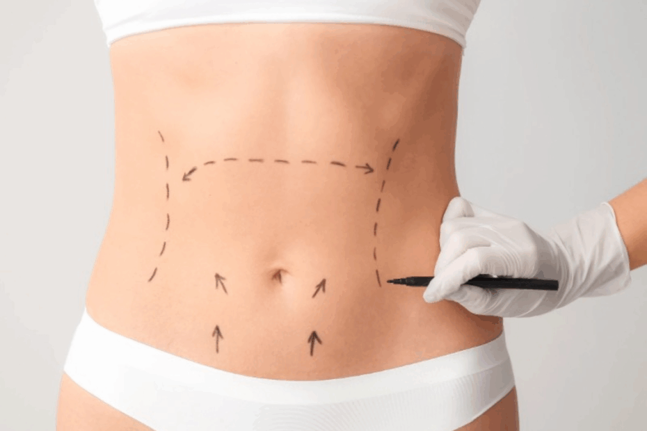 Avanços técnicos ajudam a reduzir cicatrizes cirúrgicas