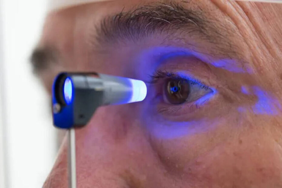 Sinais de glaucoma motivam adoção de exames regulares