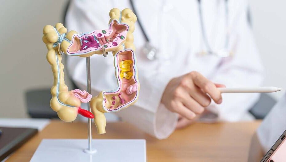 Campanha Março Azul alerta para o câncer colorretal