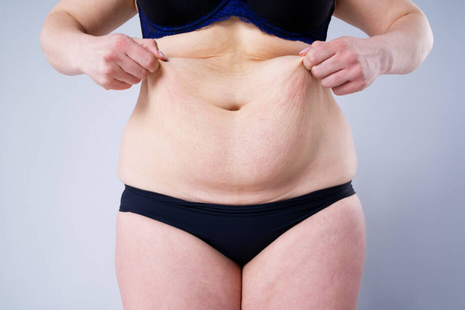 Cirurgias plásticas aumentam devido a canetas emagrecedoras