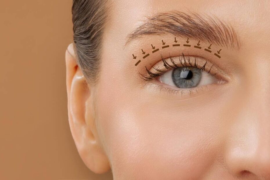 Blefaroplastia envolve função ocular além da estética