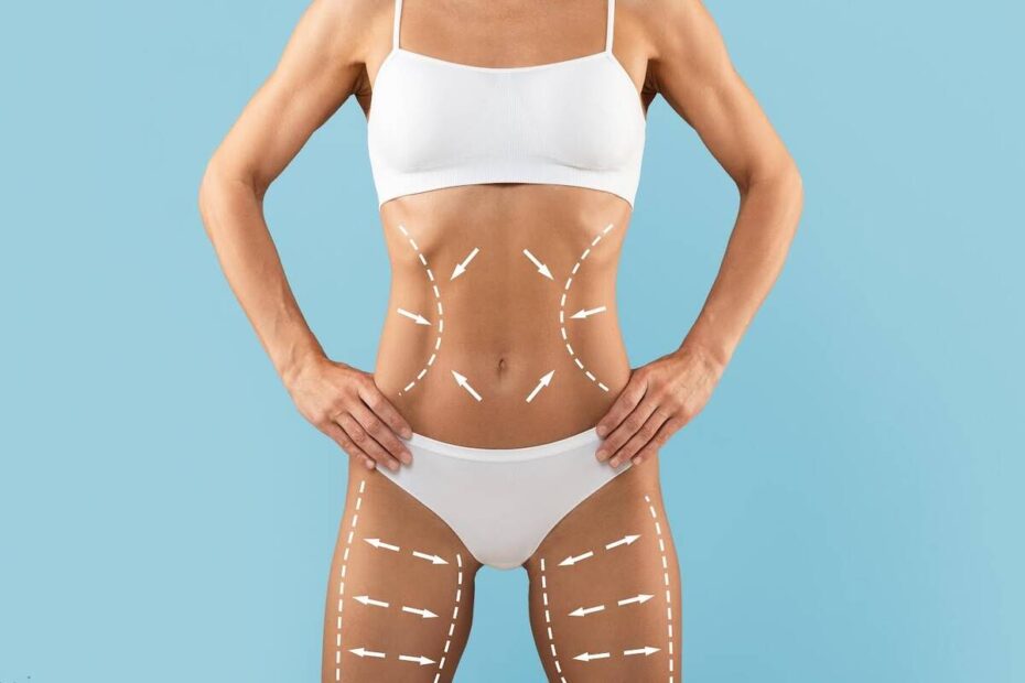 Avanços tecnológicos ampliam resultados da lipoaspiração
