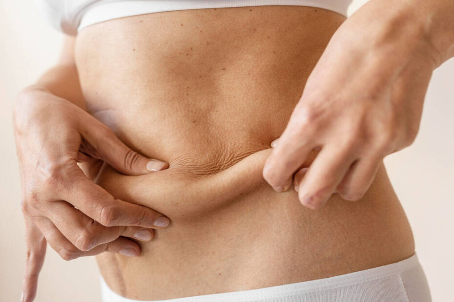 Tecnologia melhora retração da pele após lipoaspiração