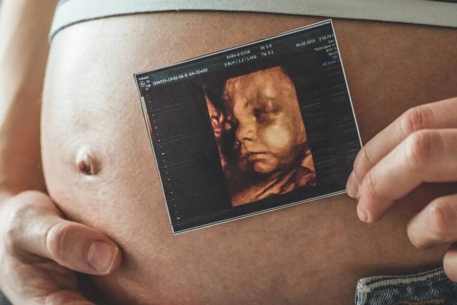 Ultrassonografia obstétrica avança no diagnóstico pré-natal