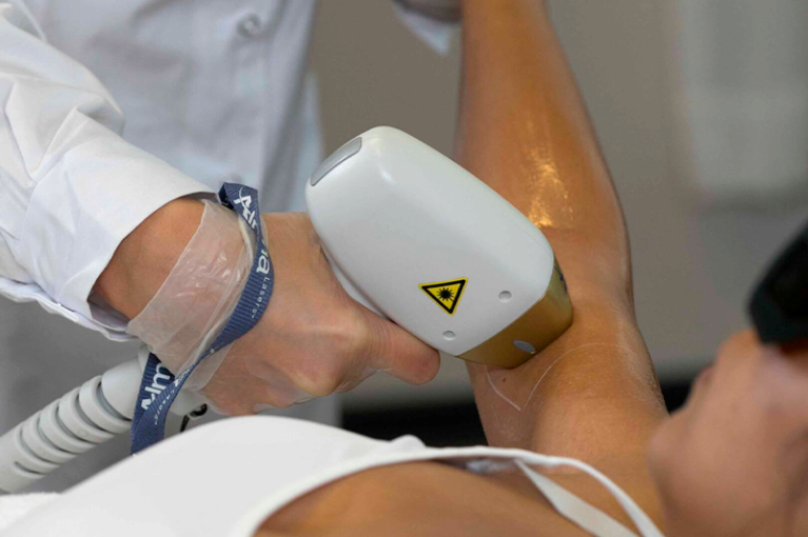 Estética não invasiva impulsiona depilação a laser
