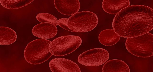 Mielodisplasia: doença silenciosa pode evoluir para leucemia