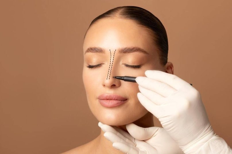 Rinoplastia associa correção estética e função respiratória