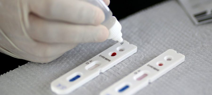 Teste novo coronavírus. Imagem: Agência Brasil