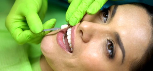 Facetas dentárias possibilitam um sorriso mais alinhado