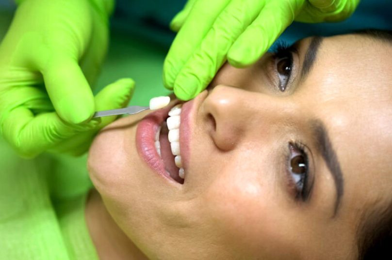 Facetas dentárias possibilitam um sorriso mais alinhado