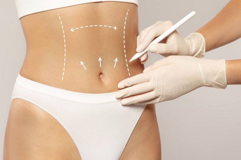 Cirurgia plástica corporal e de rejuvenescimento é tendência