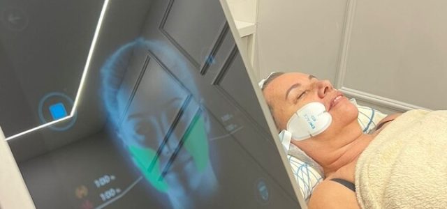 Nova tecnologia trata a flacidez facial sem uso de agulhas