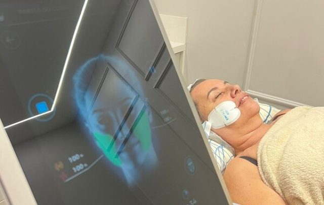 Nova tecnologia trata a flacidez facial sem uso de agulhas