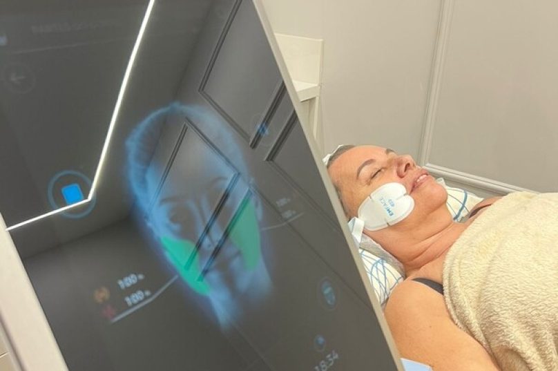 Nova tecnologia trata a flacidez facial sem uso de agulhas