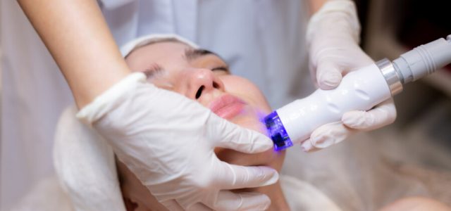 Tecnologia a laser aprimora tratamentos dermatológicos