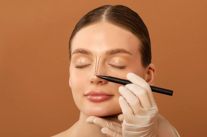 Rinoplastia alia estética e função respiratória