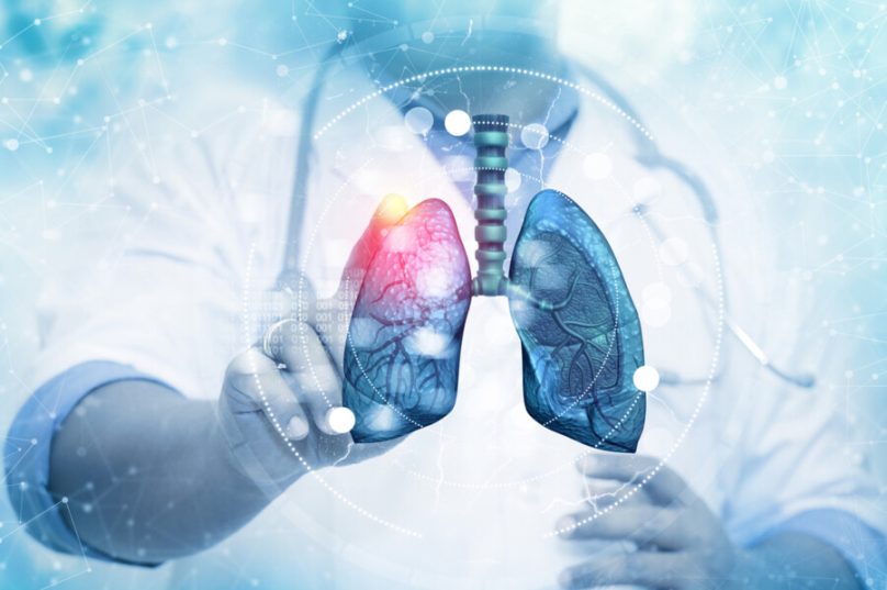 Aumento das doenças respiratórias preocupam médicos