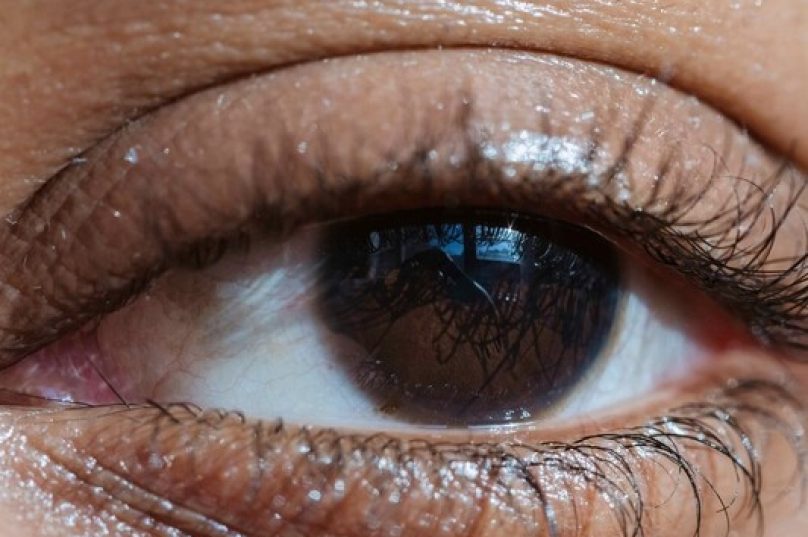 Campanha alerta sobre doença ocular relacionada à tireoide