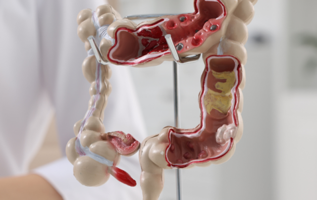 Adrian Bester lança curso on-line de modulação intestinal