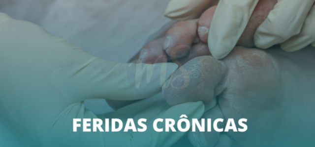 Estomaterapeuta trata ferida crônica e promove autocuidado eficaz