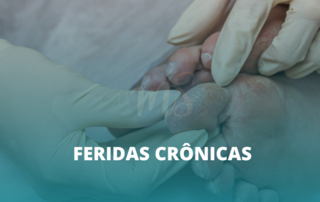 Estomaterapeuta trata ferida crônica e promove autocuidado eficaz