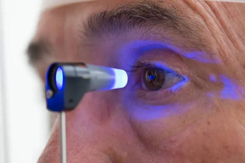 Sinais de glaucoma motivam adoção de exames regulares