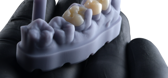 FGM Dental Group e dOne 3D apresentam a Voxelprint Ceramic