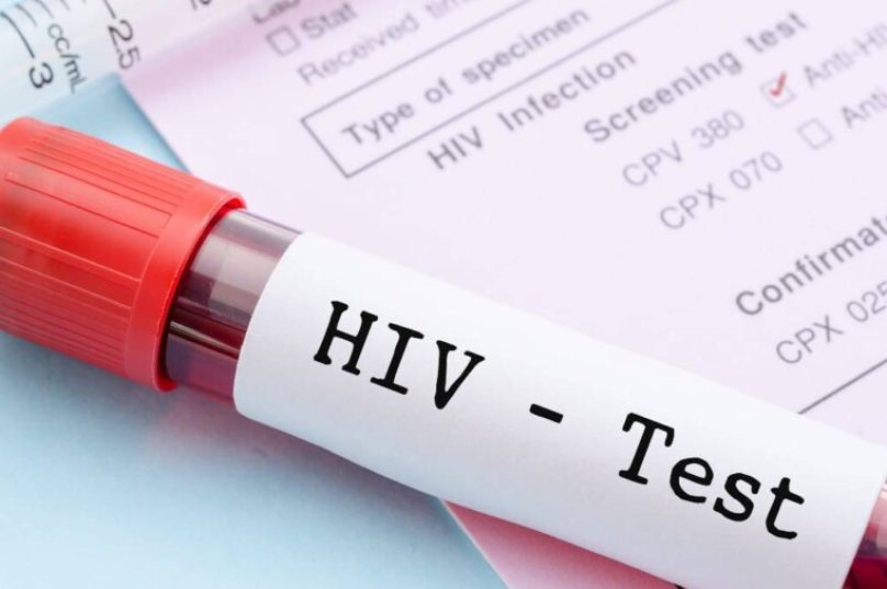 HIV-capa