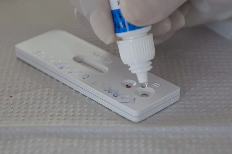 Teste-Coronavirus Foto_Rui_Porto_Filho