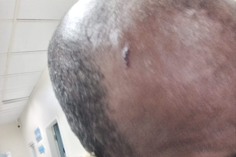 Foto mostra escoriações depois da suposta agressão sofrida por Cleiton / foto arquivo