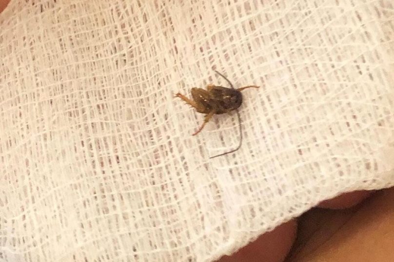 Parte da barata tinha sido removida pela equipe do Hospital de São Pedro da Aldeia. Arquivo pessoal.
