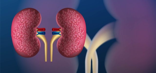 Doença renal crônica subdiagnosticada causa mortes