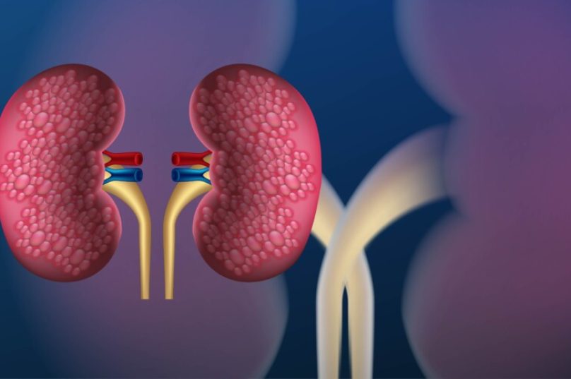 Doença renal crônica subdiagnosticada causa mortes