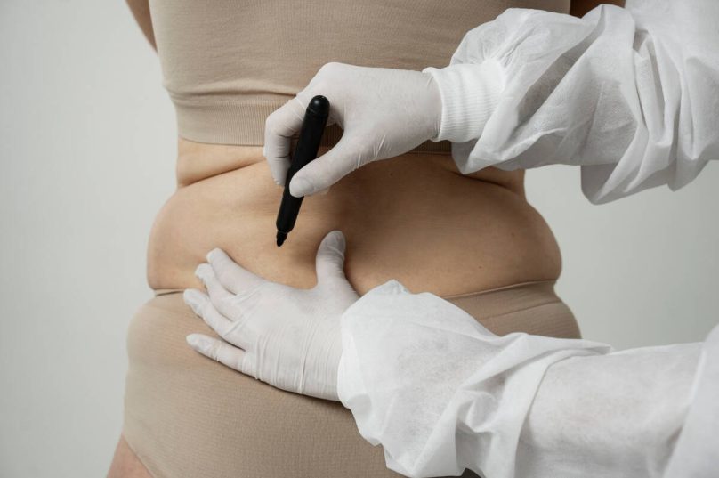 Cirurgias estéticas ultrapassam 17,4 milhões em 2024
