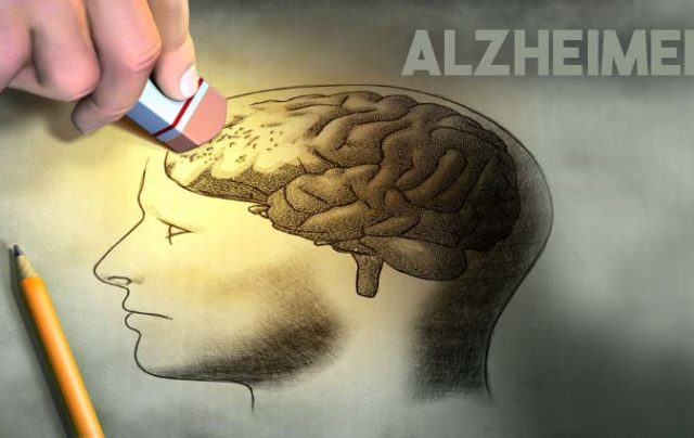 alzheimer