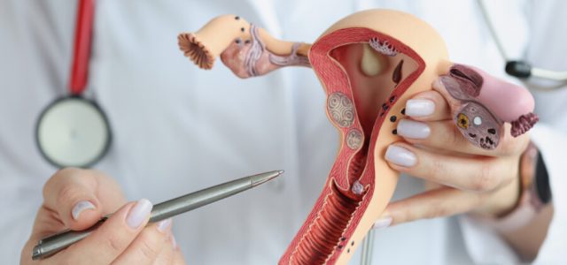 Tumores ginecológicos afetam 13% das mulheres no Brasil