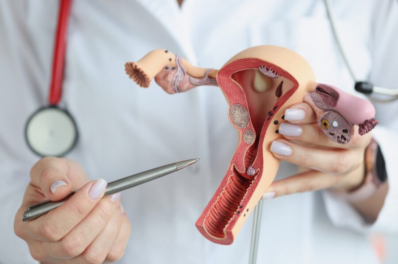 Tumores ginecológicos afetam 13% das mulheres no Brasil