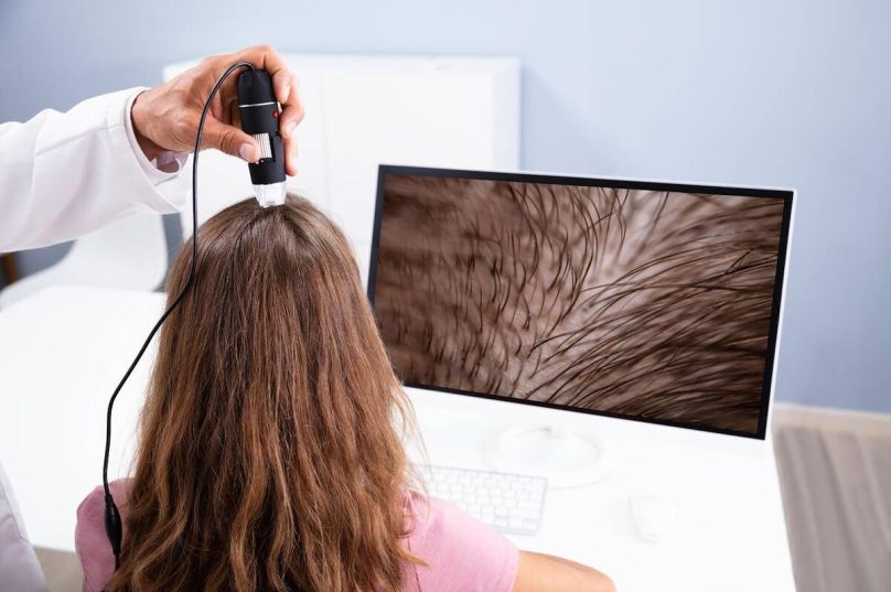 Tratamentos capilares ganham novas tecnologias