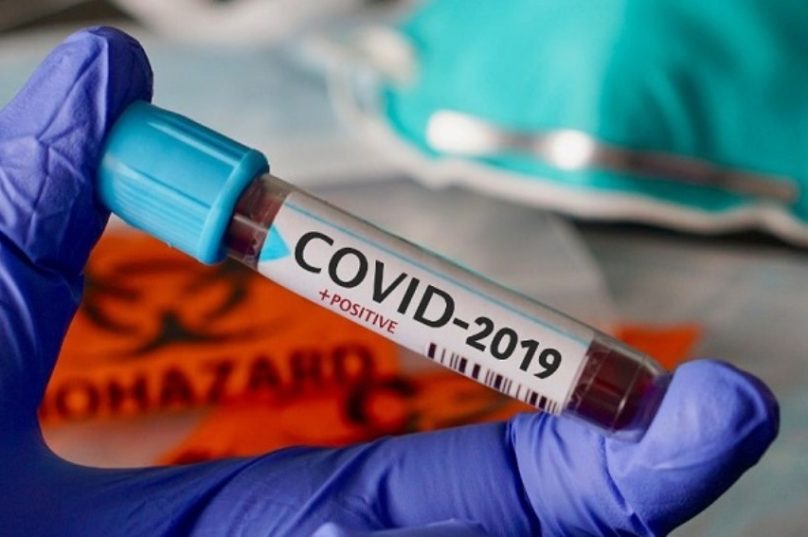 caso-positivo-covid-19