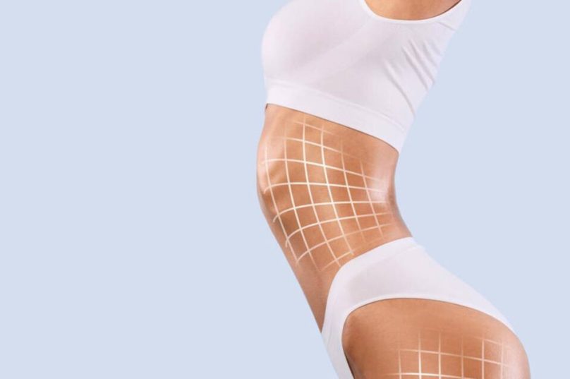 Lipo com tecnologias indica avanço na cirurgia plástica