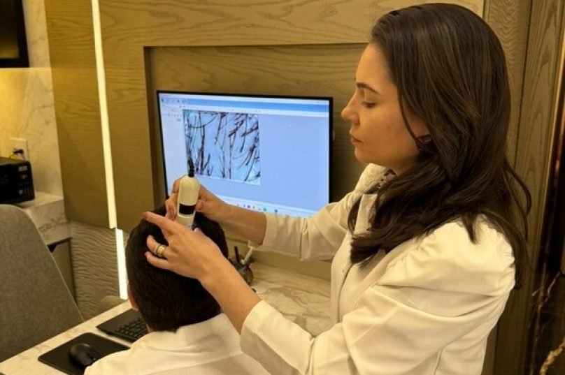 Busca por transplante capilar deve elevar 9% ao ano até 2029