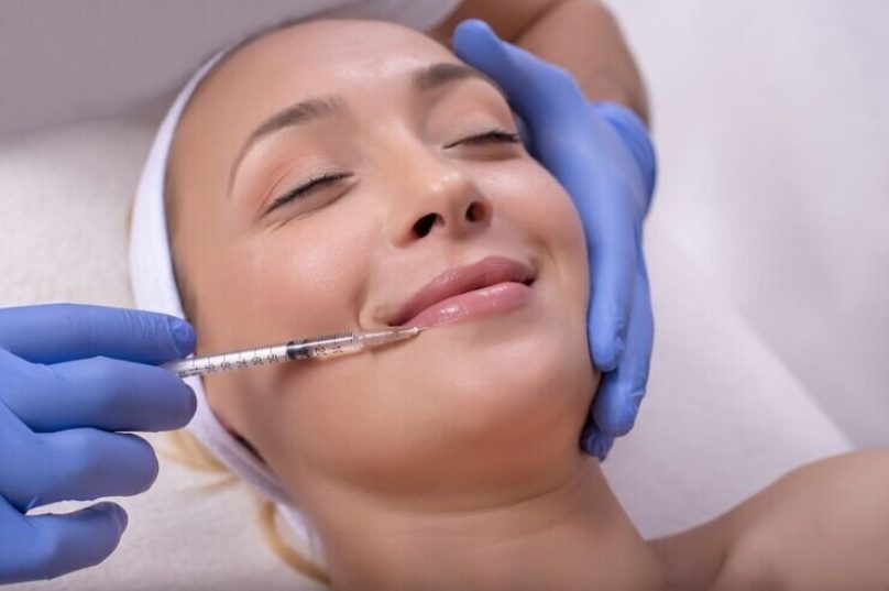 Preenchimento labial pode harmonizar o rosto de forma natural