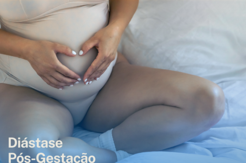Cirurgia minimamente invasiva corrige diástase pós-gestação
