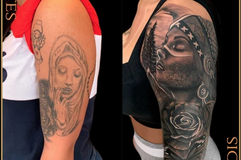 Cobertura de tatuagens tem superado as remoções a laser