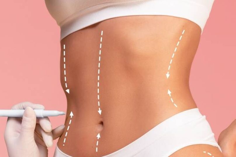 Naturalidade é a nova tendência na cirurgia plástica