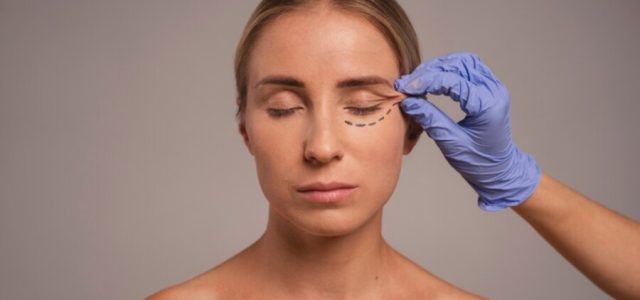 Blefaroplastia é o 3º procedimento mais realizado em 2023